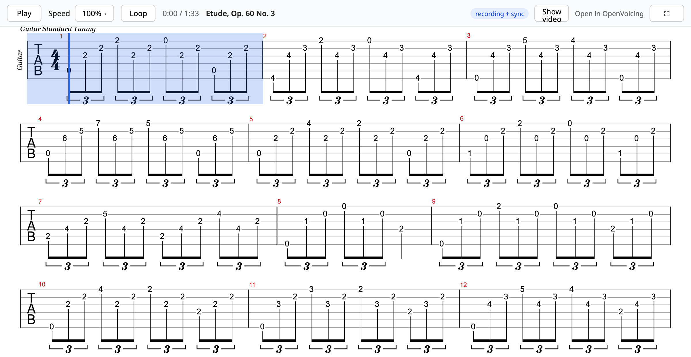 The interactive score player showing Carcassi's Etude Op. 60 No. 3, with Play, Speed, and Loop controls